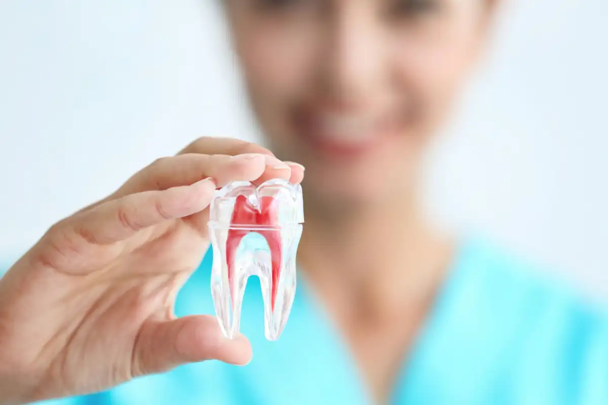 آیا دندان عصب کشی شده را می توان لمینت کرد؟
