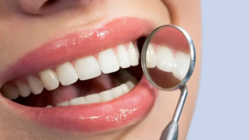 برای سفید شدن کامپوزیت دندان چه کنیم؛ انواع روش ها